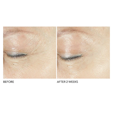 Image 1 and 2, before and after 2 week