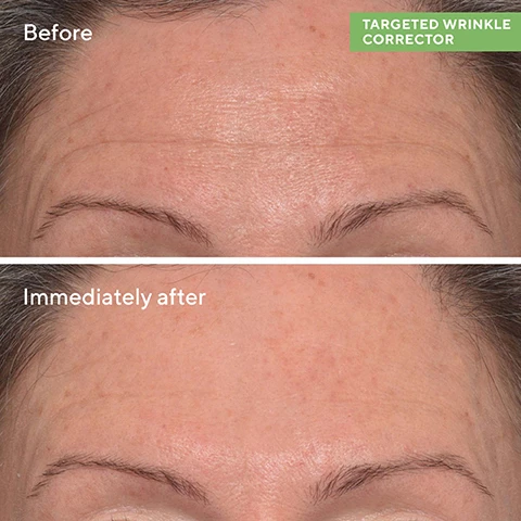 Image 1, before and immediately after. image 2 and 3, bioavailable hyaluronic acid = intensely hydrates to plump, smooth and reduce wrinkle intensity instantly. acetyl hexapeptide-8 = boost elasticity to help prevent formation of future wrinkles typical of repeated facial expressions. plant derived squalane = prevents moisture loss to help skin resist future wrinkles. image 4, 1 = morning or night, apply to clean dry skin. 2 = gently squeeze product out and tap into wrinkle with metal applicator (you can also use finger to apply) don't rub in, let it dry completely. 3 = product must be gentle tapped into wrinkle, not rubbed in to see instant results.
