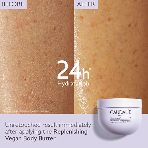 Image 1 - A side-by-side comparison showing skin before and after applying a moisturizer, with the after image indicating improved hydration; the visible text reads 24h Hydratation, Untouched result immediately after applying the Replenishing Vegan Body Butter, and CAUDALIE.
Image 2 - A person applying a creamy white moisturizer to their arm, with a jar labeled Caudalie in the background, and statistics indicating 90% soothing and 95% anti-itching effectiveness alongside the text Long-lasting comfort.
Image 3 - Five skincare products are displayed on a light purple background, with labels indicating their use: Step 1 - Hyaluronic Nourishing Body Lotion; Step 1 - Replenishing Vegan Body Butter; Step 2 - Hand & Nail Repairing Cream; Step 3 - Foot Beauty Cream; and visible cream from the Replenishing Vegan Body Butter.
Image 4 - A round jar of Caudalie Vinotherapist body cream filled with white cream, topped with a dark berry, with text displaying DESERT DATE OIL Reinforces the skin barrier, GRAPE SEED OIL Nourishing, Antioxidant, and SHEA BUTTER Nourishes, regenerates and repairs.
Image 5 - An image shows a person holding a jar of Caudalie Vinotherapist Body Butter while illustrating recycling instructions that read How to recycle the Vinotherapist™ Body Butter followed by 1. Recycle cap with Terracycle and 2. Dispose of jar in recycling bin.