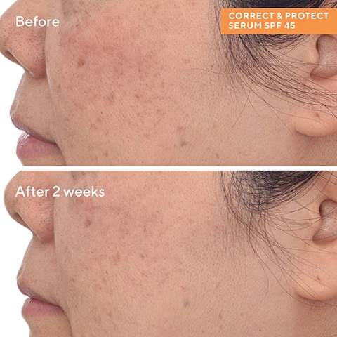 Image 1, before and after 2 weeks. Image 2, 80% showed an improvement in radiance after 2 weeks. 84% saw brighter skin after 4 weeks. as measured by expert grading in a clinical study. image 3, 100% mineral sinc oxide 16.7% sunscreen and plant extract = delivers 360-degree defense against UVA, UVB, blue light and pollution. UV responsive carotenoid technology = responsibly sourced jojoba, squalane and tomato fruit extract blend that delivers powerful antioxidant defense and absorbs UV light and reflects it to naturally enhance skin glow. beet root extract = infuses skin with comfortable, lasting hydration while stimulating vitamin d production. image 4, meet our 100% mineral SPFs/ city skin age defense SPF 50 = balanced, oily, combination skin types. shields against blue light and pollution, luxurious serum feel. no white cast. correct and protect serum SPF 45 = balanced, oily, combination, dry, sensitive skin types. shields against UV, blue light and pollution, light feel and peach tint boosts radiance. no white cast. image 5, bright skin days, everyday. a boost of barrier strengthening radiance for all skin types and tones. 1 = cleanse with essential c cleanser, rinse and pat dry. 2 = essential c toner = dispense essential c toner onto a cotton pad and sweep over face and neck. 3 = smooth essential c firming radiance day cream over face, neck and chest. 4 = apply correct and protect broad spectrum SPF 45 over face, neck and chest.