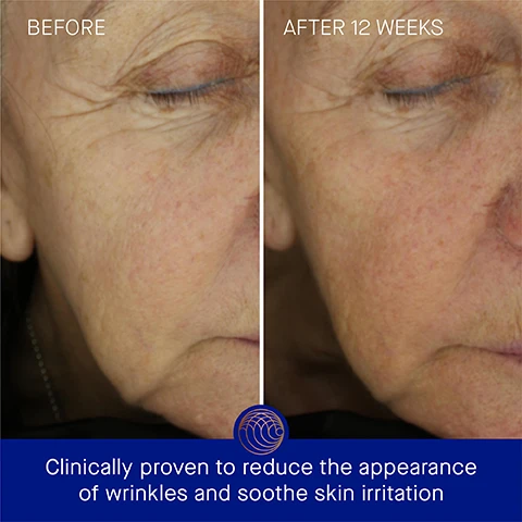 Image 3 - A side-by-side comparison shows a close-up of a womans face labeled BEFORE on the left and AFTER 12 WEEKS on the right, illustrating the reduction of wrinkles and improved skin texture, with visible text stating Clinically proven to reduce the appearance of wrinkles and soothe skin irritation at the bottom.
Image 4 - A jar of Augustinus Baders Ultimate Soothing Cream is shown with claims of clinically proven results stating that skin hydration is improved by 2.8x, fine lines are visibly reduced by 78%, and wrinkles are reduced by 79%, with a footnote about a clinical trial.
Image 5 - Image shows a blue jar of The Ultimate Soothing Cream by Augustinus Bader with a gold lid, alongside text highlighting user proven results including 100% agreement that irritated skin feels instantly soothed and calmed, 95% agreement that skin barrier feels balanced and restored, and 100% agreement that skin feels nourished and replenished, with a note about a consumer perception study.
Image 6 - A blue jar of Augustinus Baders The Ultimate Soothing Cream with a bronze lid sits against a dark gradient background, surrounded by descriptions of its key ingredients: TFC8® that promotes skin cellular renewal, Totarol that neutralizes free radicals, Evening Primrose that improves skin elasticity and texture, and Black Cumin Oil that soothes dry skin and calms redness.
Image 7 - Three moisturizer products are displayed in a side-by-side comparison: The Cream is a lightweight daily moisturizer suitable for combination to oily skin, The Rich Cream is a luxuriously rich daily moisturizer ideal for normal to dry skin, and The Ultimate Soothing Cream is an ultra-rich balm designed for very dry or irritation-prone skin, with accompanying descriptions of textures, benefits, concerns, and ideal skin types for each product.
Image 8 - A skincare routine labeled The Routine includes four steps: 1. Cleanse - The Cream Cleansing Gel, 2. Correct & Hydrate - The Serum, 3. Nourish & Renew - The Ultimate Soothing Cream, and 4. Perfect & Revitalize - The Eye Cream, alongside corresponding product images.