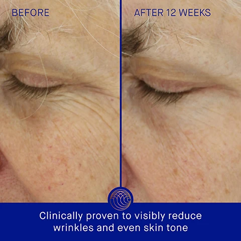 Image 1 - A split image shows skin around an eye before and after treatment with the text BEFORE, AFTER 12 WEEKS, and Clinically proven to visibly reduce wrinkles and even skin tone. Image 2 - Image shows a blue Augustinus Bader The Light Cream bottle next to text reading Clinically Proven Results Skin sebum is reduced by 38% Pores look 54% less noticeable Skin hydration is improved by 3.1x In a 12-week Clinical Trial of 60 m/f, ages 18+ with self-perceived sensitive skin. Image 3 - An image displays two bottles of Augustinus Bader The Light Cream next to a list of user study results which reads: User Proven Results, 99% agree skin looks and feels fresh and hydrated, 96% agree The Light Cream provides immediate and all-day oil control, 93% agree the appearance of pores is immediately minimized, AB Augustinus Bader, The Light Cream With TFC8, La Creme Hydratante Legere Avec TFC8, 30 ml e, 1 fl. oz., *In a 12-week Consumer Perception Study of 105 m/f, ages 18+ with self-preceived sensitive skin. Image 4 - A blue bottle of Augustinus Bader The Light Cream is shown against a blue background with white circles alongside text describing its features and ingredients: TFC8 A proprietary technology that creates the optimal environment for skin cellular renewal AB Augustinus Bader THE LIGHT CREAM WITH TFC8 LA CRÈME HYDRATANTE LÉGÈRE AVEC TFC8 30 ml e 1 fl. oz. AUSTRALIAN LEMON MYRTLE EXTRACT Balances sebum levels, reducing appearance of shine BAOBAB LEAF EXTRACT Improves elasticity, tone and appearance of wrinkles CALMING DUO Calms irritation and redness. Image 5 - A comparison chart shows Augustinus Bader The Light Cream with texture Ultra-lightweight daily moisturizer key benefits Mattifying & Balancing key concerns Oil, pores, redness, irritation, dryness ideal for Oily skin, or humid, congested climates; The Cream with texture A lightweight daily moisturizer key benefits Hydrating & Revitalizing key concerns Dryness, dark spots, blemishes, dullness, fine lines & wrinkles ideal for Combination to oily skin; and The Rich Cream with texture A luxuriously rich daily moisturizer key benefits Nourishing & Renewing key concerns Dryness, fine lines & wrinkles, loss of firmness & elasticity, uneven texture, dark spots ideal for Normal to dry skin. Image 6 - A visual guide showing 5 steps for using skincare products titled How to Use, with text listing step 1 Cleanse THE CREAM CLEANSING GEL / THE CLEANSING BALM, step 2 Tone & Exfoliate THE ESSENCE, step 3 Correct & Illuminate THE SERUM, step 4 Balance & Hydrate THE LIGHT CREAM, and step 5 Revitalize & Refresh THE EYE CREAM, each step featuring product images.