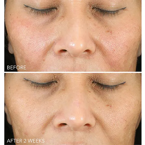 Image 1 and 2 - Before and after model shots