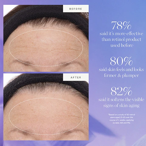 Image 1 - Before and after images showing a forehead with wrinkles in the before image and fewer wrinkles in the after image, with text BEFORE AFTER 78% said its more effective than retinol product used before 80% said skin feels and looks firmer & plumper 82% said it softens the visible signs of skin aging Based on a study of 50 retinol users aged 25-65 over the course of 4 weeks, applying 2x daily AM and PM. Image 2 - Close-up of dark blueberries with the text ACAI PLANT STEM CELL TIGHTEN FIRM SMOOTH. Image 3 - Image displays two sets of Kora Organics serum packaging, labeled as old and new, with the text New Look, Same Formula NEW and Please note: Packaging may vary. For a limited time, you may receive either of these packages.