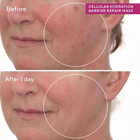Image 1, before and after 1 week. image 2, soothes - with a shot of intense hydration to rescue skin from dryness, redness and roughness. overnight - prevents water loss and strengthens skin barrier. with every use = hydrates and mends the skin barrier at cellular level. image 3, murad ingredients plus. canadian willowherb = reduces damage from oxidative stress. hibiscus extract = delivers potent hydration protects from water loss. handpicked bilberries = support a healthier barrier with omegas 3 and 6. image 4, your skin barrier repair regime. treats at a cellular level. 1 = soothing oat peptide cleanser - cleanse, rinse and pat dry. 2 = cellular hydration repair serum - apply an even later of serum onto clean skin. 3 = cellular hydration repair cream - massage cream evenly over face, neck and chest. apply SPF in the morning. 4 = celluar hydration repair mask - on nights your skin needs extra hydration, massage mask over face and neck, do not rinse until the morning.