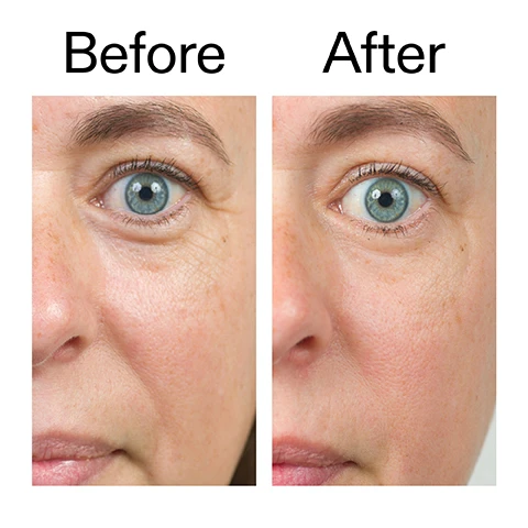 Image 1 - A before and after comparison showing a close-up of a persons eye and cheek, with the Before image on the left displaying more wrinkles around the eye and the After image on the right showing smoother skin with fewer wrinkles. Before After Image 2 - Close-up of a smiling woman with her eyes closed, touching her cheek, next to text that reads: Clinically proven to reduce signs of skin sensitivity and dryness* Improves hydration levels by up to 160% after 1 hour. Clinically proven to reduce fine lines and improve skin firmness and barrier function in 28 days** *4-week independent consumer study of 22 people under dermatological and ophthalmological control **4-week clinical study of 20 people. Image 3 - A close-up of a smiling persons face with hydrated skin and pink lips, displaying text that reads Why we love Ectoin Hydro-Barrier Serum, Hydrates and strengthens the skin barrier, Lightweight and non-sticky, Helps add bounce and firm skin. Image 4 - Close-up of a persons smiling face with visible wrinkles around the eyes and a hand gently touching their cheek, next to text that reads Why we love Bio-Active Ceramide Moisturiser: Smooths, firms and deeply hydrates. Strengthens the barrier. Rich, non-greasy formula. Image 5 - An image with a soft, abstract white and grey background, showcasing instructions for layering skincare products: How to layer Barrier Boosting Duo 1 Ectoin Hydro-Barrier Serum AFTER CLEANSING, APPLY A PEA-SIZED AMOUNT TO FACE AND NECK. LET IT FULLY ABSORB. 2 Bio-Active Ceramide Moisturiser MASSAGE INTO FACE AND NECK TO LOCK IN HYDRATION AND SUPPORT BARRIER RECOVERY. Image 6 - A tall white bottle of The Inkey List Ectoin Hydro-Barrier Serum 1.0 US fl.oz / 30ml stands next to a white jar of The Inkey List Bio-Active Ceramide Repairing and Plumping Moisturizer 1.7 US fl.oz / 50ml, with a red CEW UK Beauty Award Winner 2025 sticker partially visible above the serum bottle.